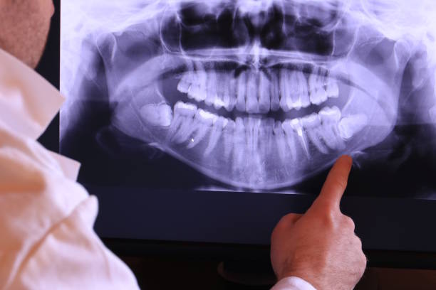 Best Broken or Cracked Tooth Emergency Dentist in Calvert City, KY